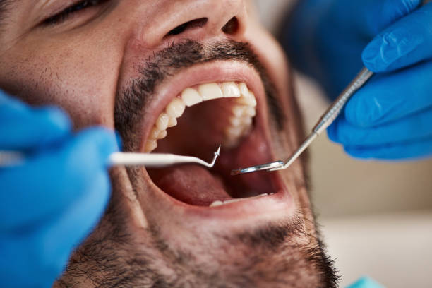 Best Emergency Denture Repair in Somersworth, NH